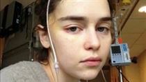 Emilia Clarkeová po operaci mozku v roce 2011. | na serveru Lidovky.cz | aktuální zprávy