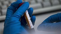Záběr z dopingové laboratoře. | na serveru Lidovky.cz | aktuální zprávy