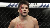I přes ošklivou tržnou ránu vyhrál Henry Cejudo nad Dominickem Cruzem v rámci... | na serveru Lidovky.cz | aktuální zprávy