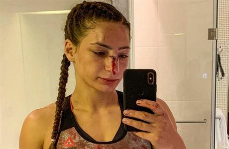 Lijana Jojuaová po zápase. | na serveru Lidovky.cz | aktuální zprávy Lijana Jojuaová po zápase. | na serveru Lidovky.cz | aktuální zprávy