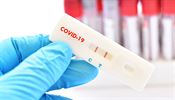 Česko si epidemicky polepšilo, podle počtu nákaz je desáté z EU. Nejhorší situace je nyní v Maďarsku Test na covid | na serveru Lidovky.cz | aktuální zprávy