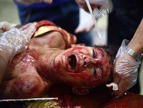 Nejhorší je, že díky momentální Putinově teroristické ideové linii, kdy se snaží dostat bombardováním USA k jednacímu stolu, umírají tisíce nevinných lidí, mezi nimi stovky dětí...Život civilisty nikdy neměl pro vládce Ruska pražádnou hodnotu...