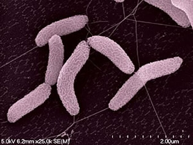 Desulfovibrio vulgaris