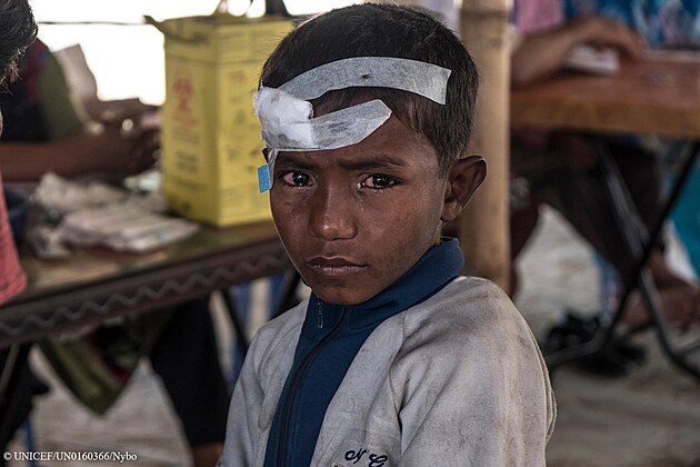6let Yasin v registranm centru pro rohingsk uprchlky v Bangladi. Vojci myanmarsk armdy ho zbili a zranili, kdy vtrhli do domu rodiny a Yasin nebyl schopen ct, kde se nachz jeho otec. 58 procent rohingskch uprchlk z Myanmaru jsou dti.