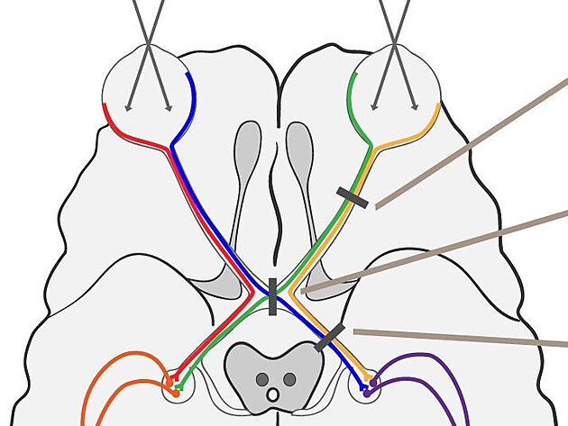 Nervy vedouc optick vjemy z naich o, se spojuj v mozku.