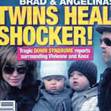 Podle asopisu mly mt dvojata Angeliny a Brada Downv syndrom...