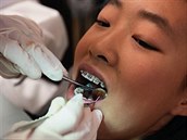 Pokud jde o zuby, v�dy vyhledejte pomoc odborníka.