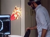 V budoucnosti budou mladí lékai budou moci studovat lidské tlo za pomoci...