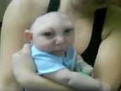 Malý Jaxon doká�e mluvit i chodit, navzdory svému posti�ení.