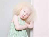 Fotografka Angelina d�Auguste cht�la zachytit k�ehkou krásu albín�.