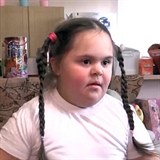 Malá Máša s Downovým syndromem vyvolala v Rusku pozdvižení mezi rodiči, kteří...