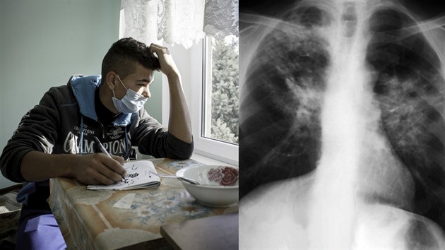 Nemocný tuberkulózou musí být v karantén.
