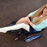Sportovkyn u 4 roky bojuje za to, aby j noha byla amputovna.