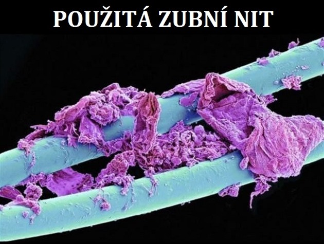 Pouitá zubní nit.