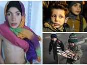 Hlad v obléhaném syrském mst