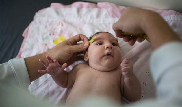 Brazílii suuje epidemie viru zika. Ten zpsobuje, e se dti rodí se zakrnlou...