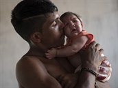 Virem zika jsou postieny nejvíce chudé oblasti Brazílie.
