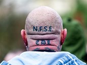 Hlavu demonstranta zdobila neonacistická tetování. EDL je zkratkou...