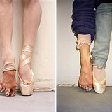 Nohy kehk baletek jsou pln odenin a zarostlch nebo zlmanch neht.