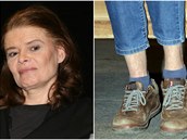 Zuzana ukázala zarostlé nohy.