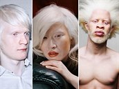 Albíni se prosazují v módním pr�myslu. Nalezneme mezi nimi mu�e i �eny a...