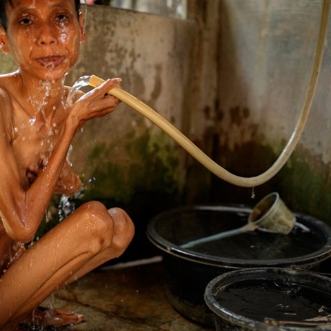 Anne je v bl�zinci deset let, v�t�inu pobytu str�vila v cele bez okna, ani moc nejedla. Skoro se nepostav� na vlastn� nohy.