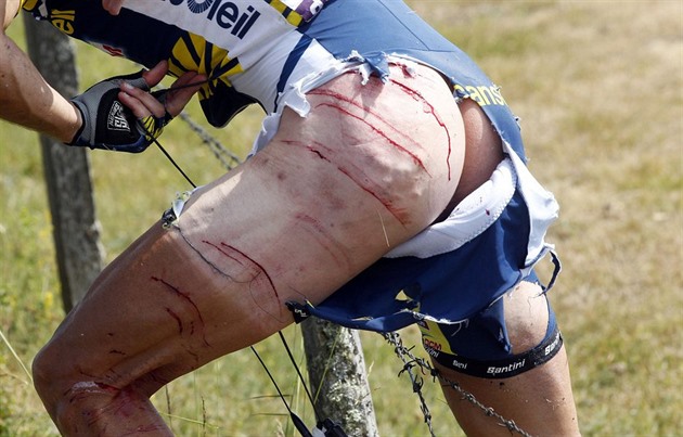 Holanan Johnny Hoogerland se zle poranil na Tour de France v roce 2011.