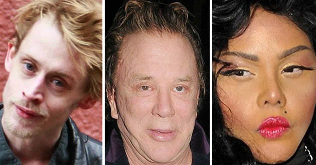 Celebrity, které propadly plastickýcm operacím