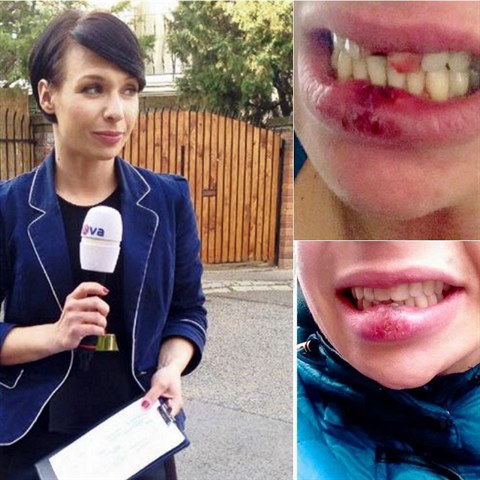 Báře Divišové měl její expartner vymlátit zuby. To alespoň novácká reportérka...
