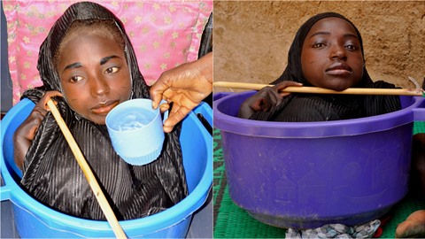 Rahma Haruna je dívka z Nigérie, které se nevyvinuly konetiny.