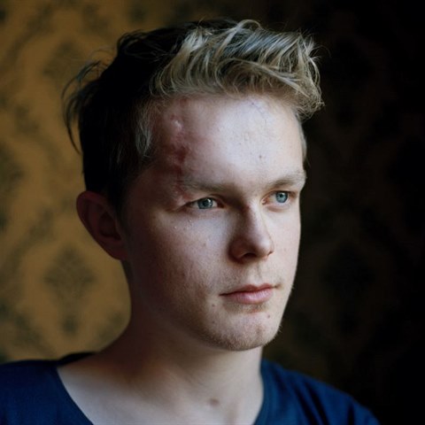 Viljara Hanssena (18) trefil stelec celkem ptkrt, mimo jin do hlavy. Kvli...