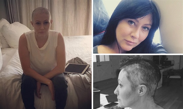 Shannen Dohertyová si kvli rakovin ped asem oholila hlavu.