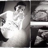 Pochlubila se fotkou z ultrazvuku.
