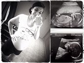 Pochlubila se fotkou z ultrazvuku.