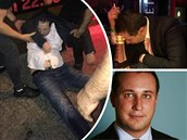 Kalousk�v politik Lapá�ek nezvládl alkohol.