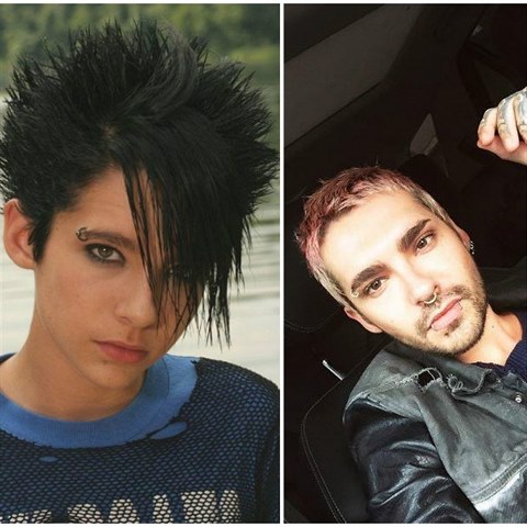 Bill Kaulitz v dob, kdy Tokio Hotel zanali (vlevo). Dnes nos rovho jeka.