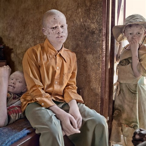 Krut realita africk Tanzanie. Pro lidi postien albinismem musely vzniknout...