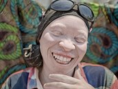 Pro mnohé starí albíny je to vbec poprvé, co mohou ít beze strachu o vlastní...