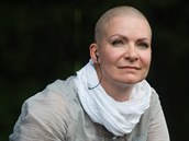 Anna K bojovala s rakovinou prsu.