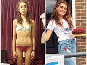 Margherita Barbieri (18) pemohla anorexii. Byly ale doby, kdy váila jen 25...