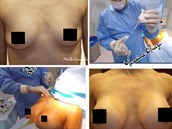 Léka neváhal na Instagram nahrát intimní fotografie pacientek.
