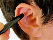 V uích je mnoho nervových zakonení, proto nám pináí rzné druhy potení....