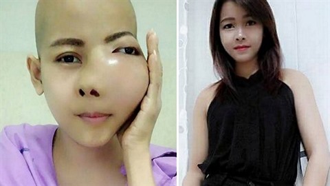 Sedmadvacetiletá thajská kráska Jennie Yoo onemocnla agresivní formou rakoviny...