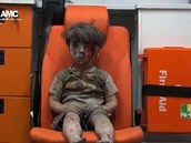 okovaný syrský chlapec Omran v sanitce po zásahu bhem obléhání Apleppa se...