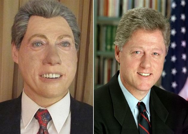 Bill Clinton podle autora jeho figurny nejspe trp mikrocefalismem a demenc.
