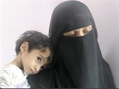 Dti v Jemenu hladoví a celý svt je lituje.