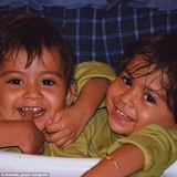 Lupita a Carmen se narodily jako siamsk dvojata.