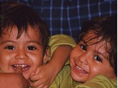 Lupita a Carmen se narodily jako siamská dvojata.