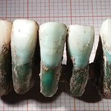 Tato pedpotopn zubn protza byla nalezena v italskm mst Lucca.