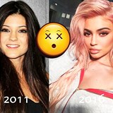 Kylie Jenner 2011 vs 2016